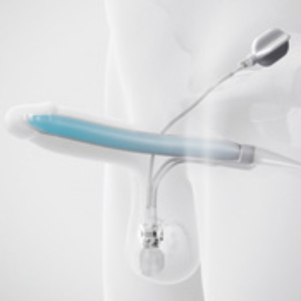 Illustration of Titan® Inflatable Penile Implant